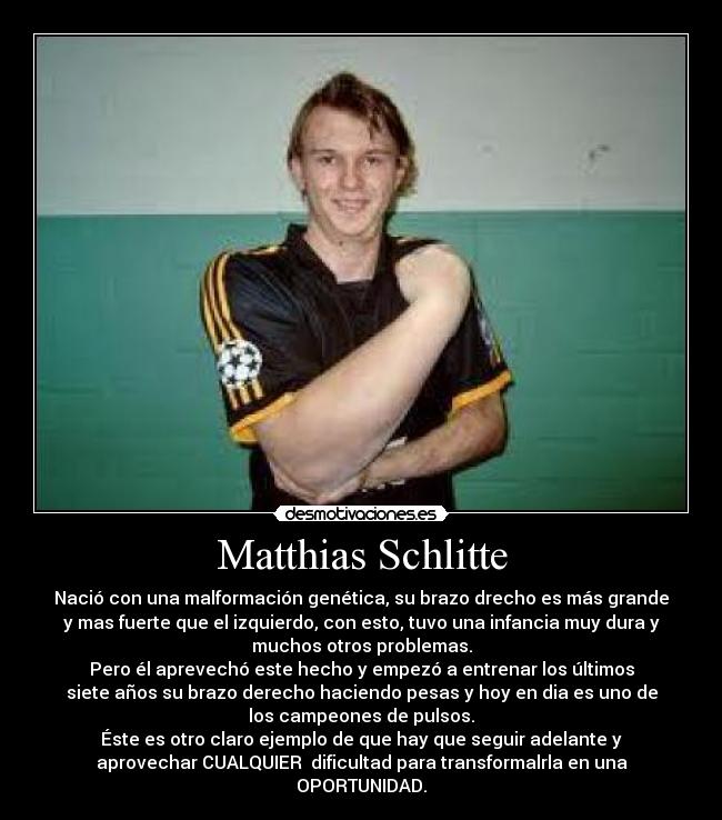 Matthias Schlitte - Nació con una malformación genética, su brazo drecho es más grande
y mas fuerte que el izquierdo, con esto, tuvo una infancia muy dura y
muchos otros problemas.
Pero él aprevechó este hecho y empezó a entrenar los últimos
siete años su brazo derecho haciendo pesas y hoy en dia es uno de
los campeones de pulsos.
Éste es otro claro ejemplo de que hay que seguir adelante y
aprovechar CUALQUIER  dificultad para transformalrla en una
OPORTUNIDAD.