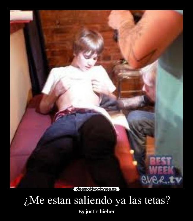 ¿Me estan saliendo ya las tetas? - 