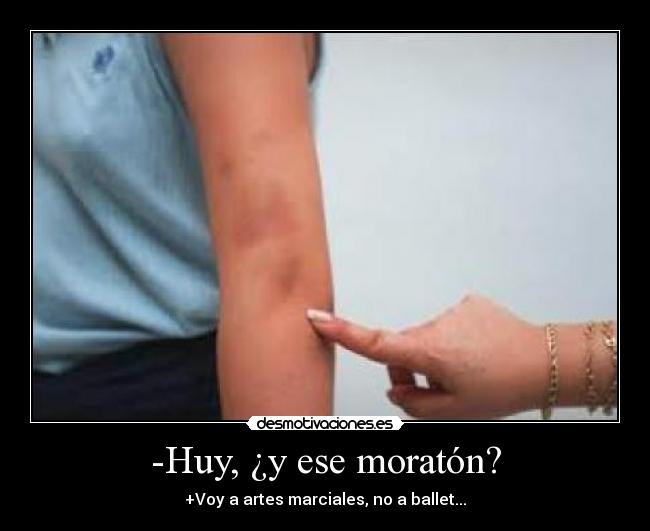 -Huy, ¿y ese moratón? - +Voy a artes marciales, no a ballet...