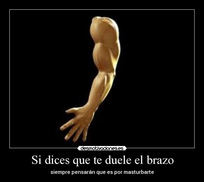 Si dices que te duele el brazo -
