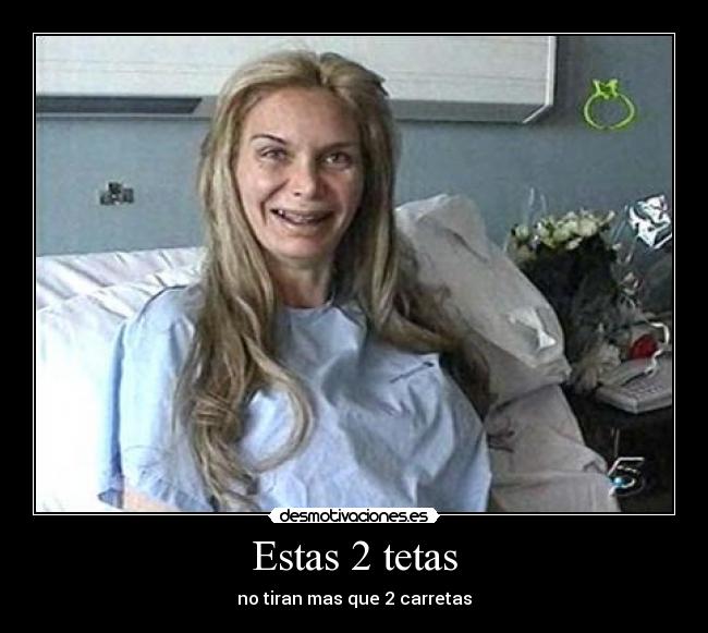 Estas 2 tetas -