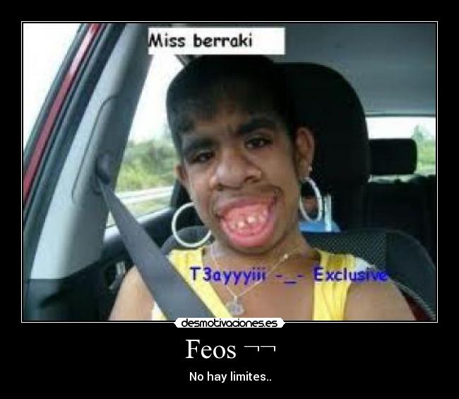 Feos ¬¬ -