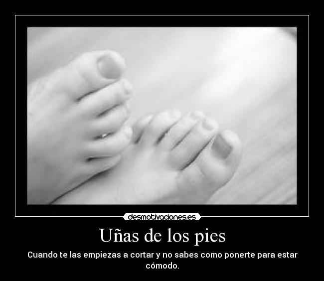 Uñas de los pies - 