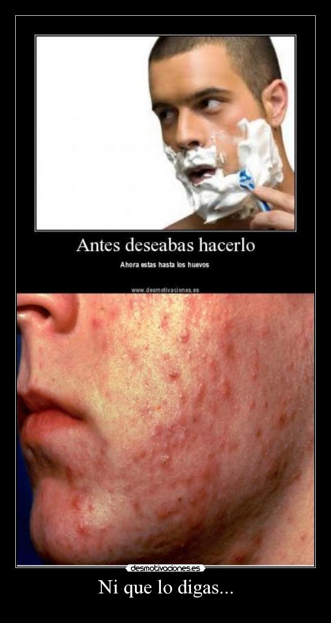 Ni que lo digas... -