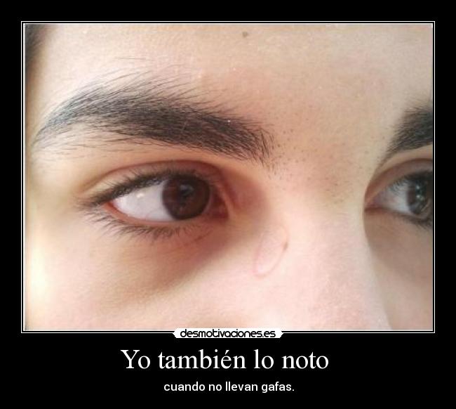Yo también lo noto  - 