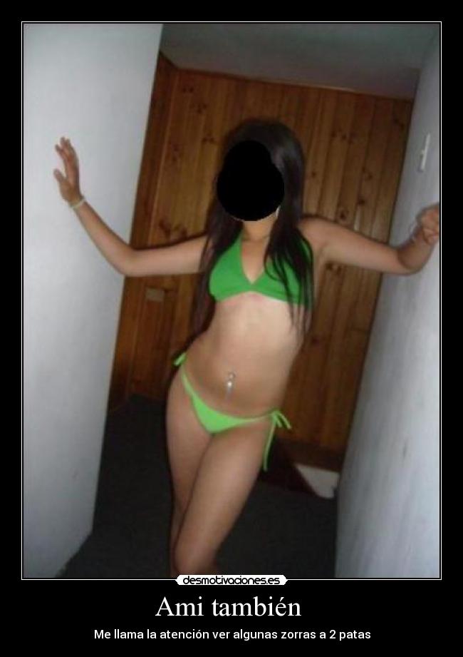 Ami también - Me llama la atención ver algunas zorras a 2 patas