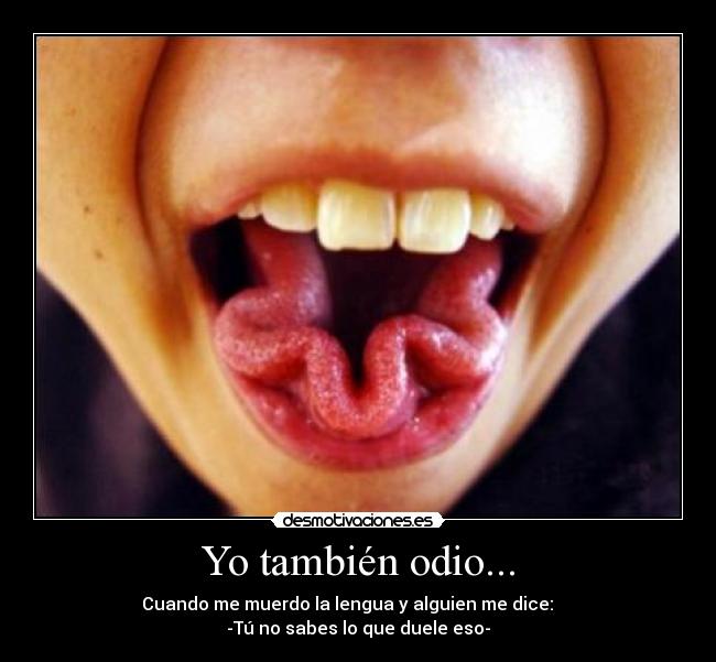 Yo también odio... - 
