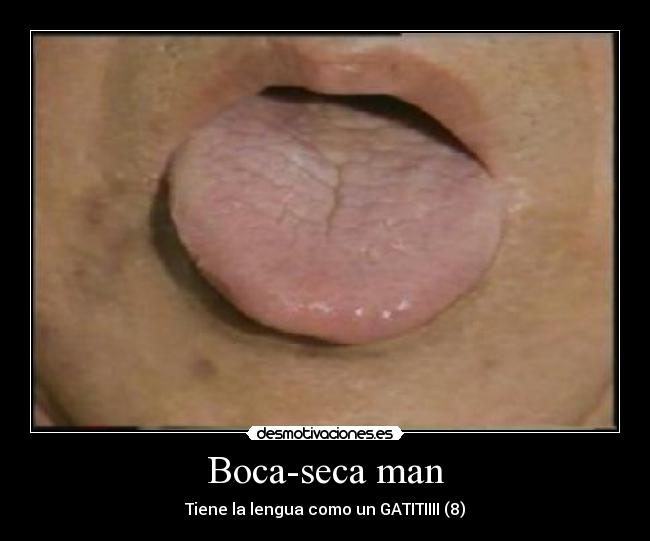 Boca-seca man - Tiene la lengua como un GATITIIII (8)