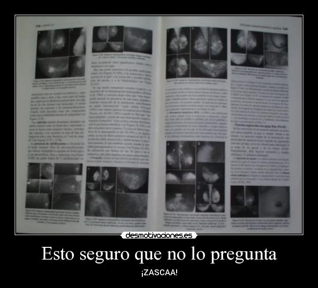 Esto seguro que no lo pregunta - ¡ZASCAA!