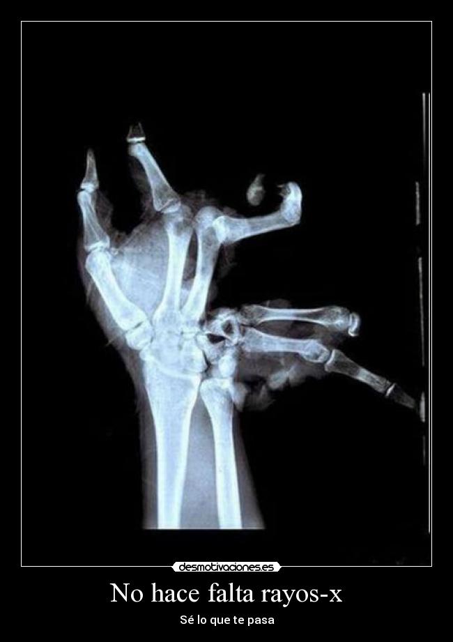 No hace falta rayos-x - 