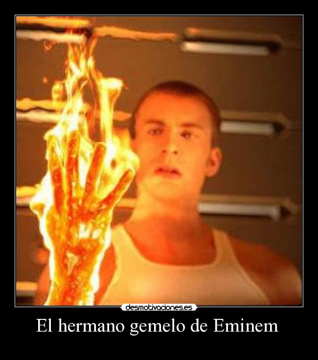 El hermano gemelo de Eminem -