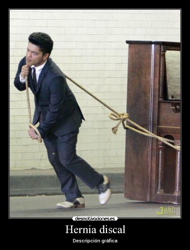 Hernia discal -