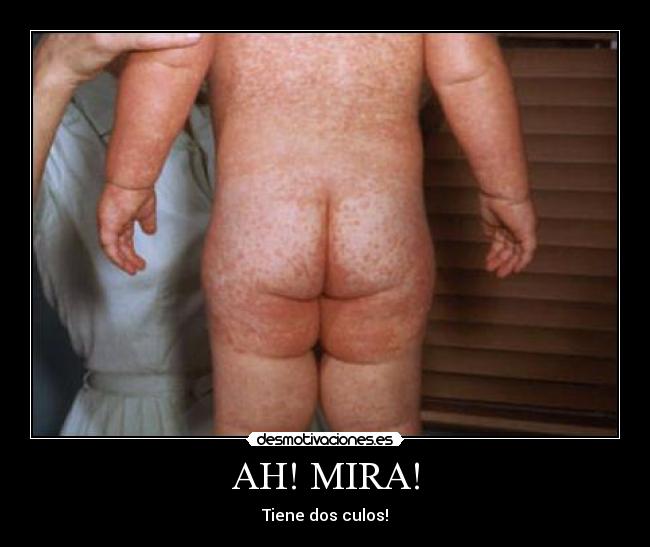 AH! MIRA! - Tiene dos culos!