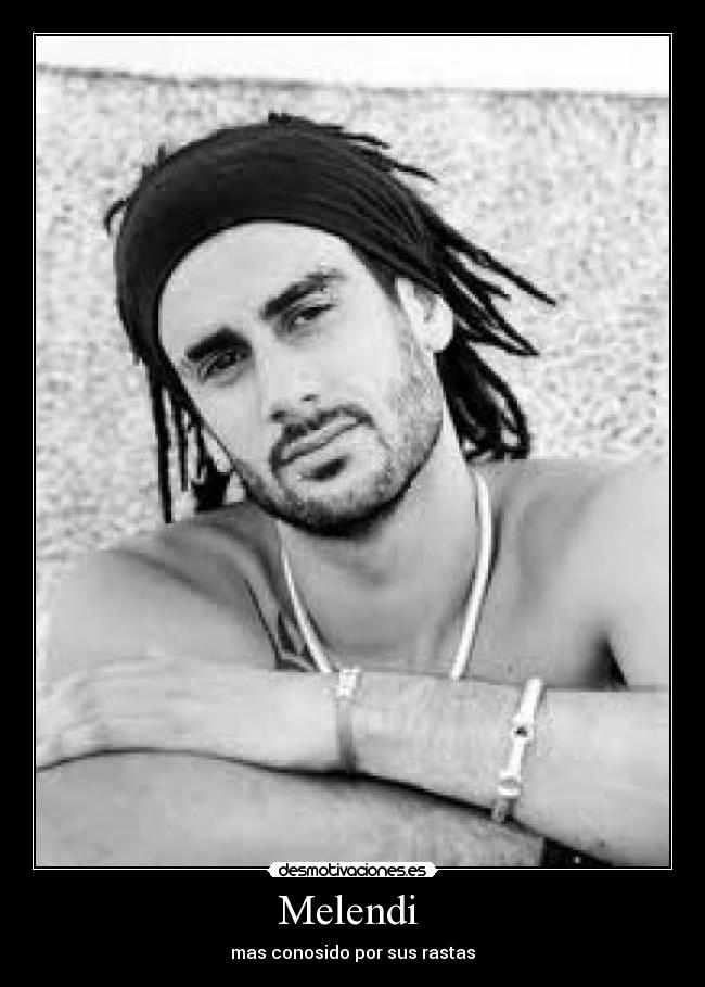 Melendi - mas conosido por sus rastas