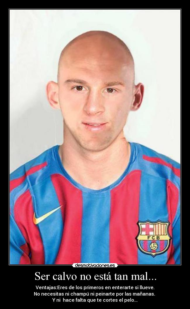 Ser calvo no está tan mal... - Ventajas:Eres de los primeros en enterarte si llueve.
No necesitas ni champú ni peinarte por las mañanas.
Y ni hace falta que te cortes el pelo...