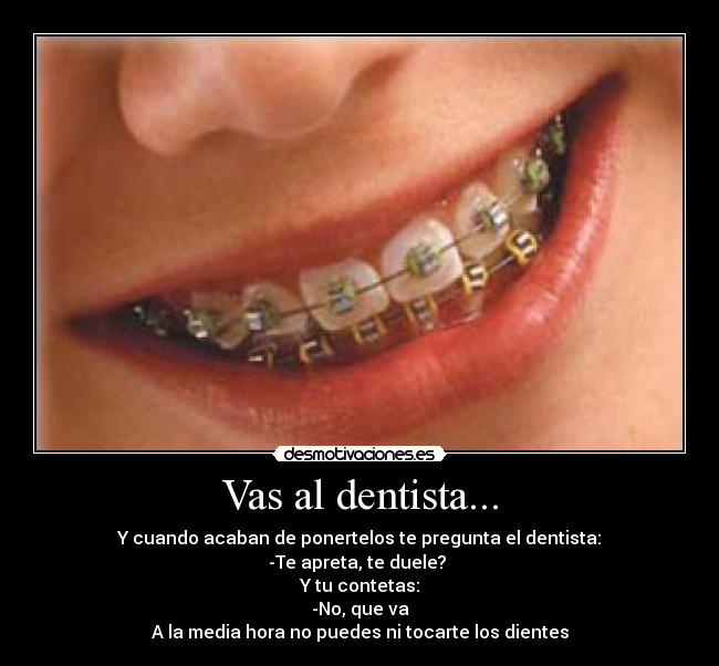 Vas al dentista... - Y cuando acaban de ponertelos te pregunta el dentista:
-Te apreta, te duele? 
Y tu contetas:
-No, que va
A la media hora no puedes ni tocarte los dientes