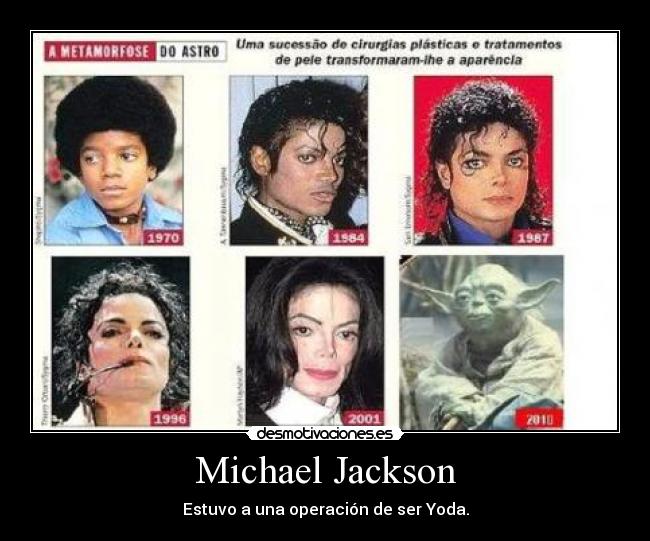 Michael Jackson - Estuvo a una operación de ser Yoda.