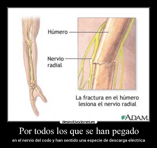 Por todos los que se han pegado - en el nervio del codo y han sentido una especie de descarga eléctrica