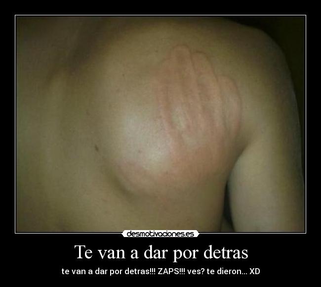 Te van a dar por detras - te van a dar por detras!!! ZAPS!!! ves? te dieron... XD