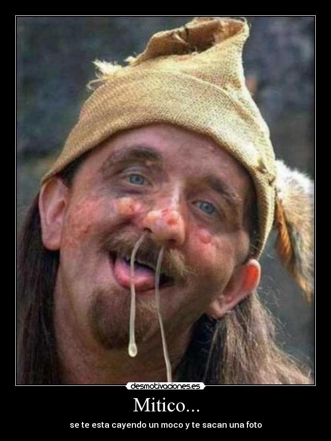 Mitico... - se te esta cayendo un moco y te sacan una foto