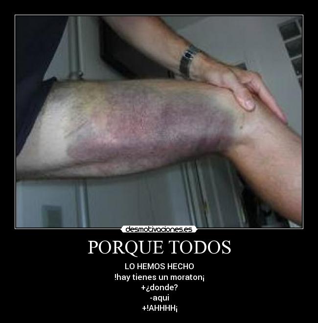 PORQUE TODOS - LO HEMOS HECHO
!hay tienes un moraton¡
+¿donde?
-aqui
+!AHHHH¡