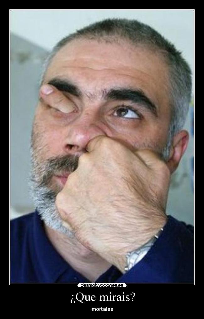 ¿Que mirais? - mortales
