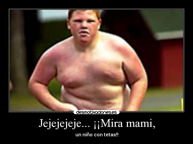 Jejejejeje... ¡¡Mira mami, - un niño con tetas!!