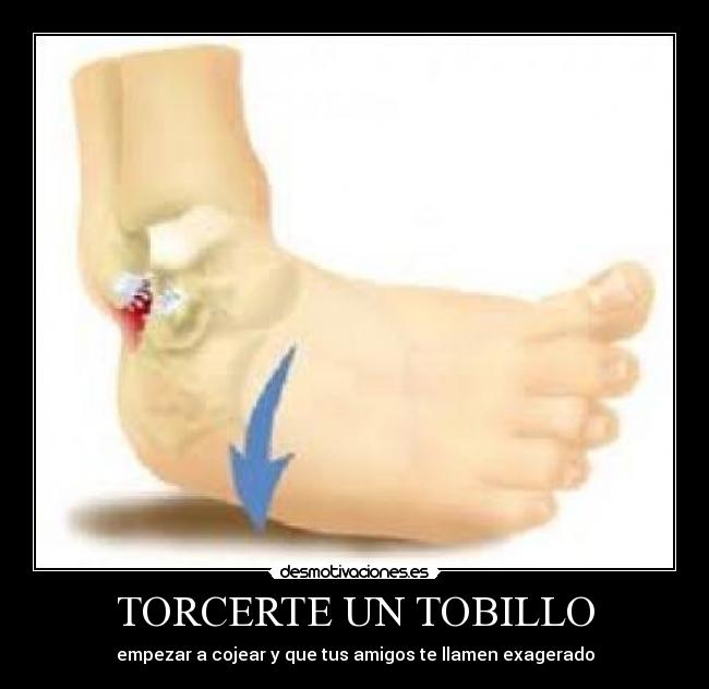 TORCERTE UN TOBILLO - empezar a cojear y que tus amigos te llamen exagerado