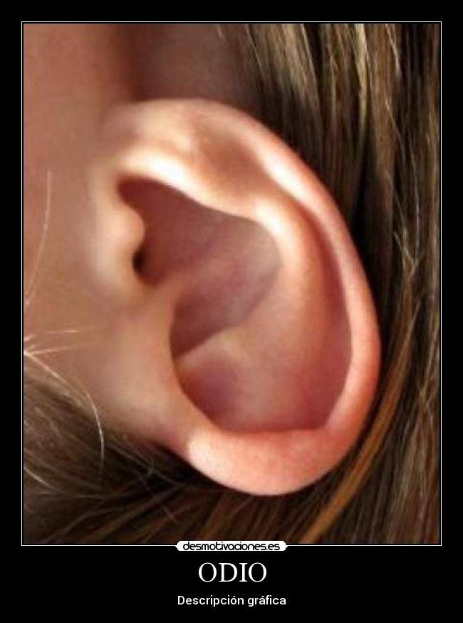 ODIO - Descripción gráfica