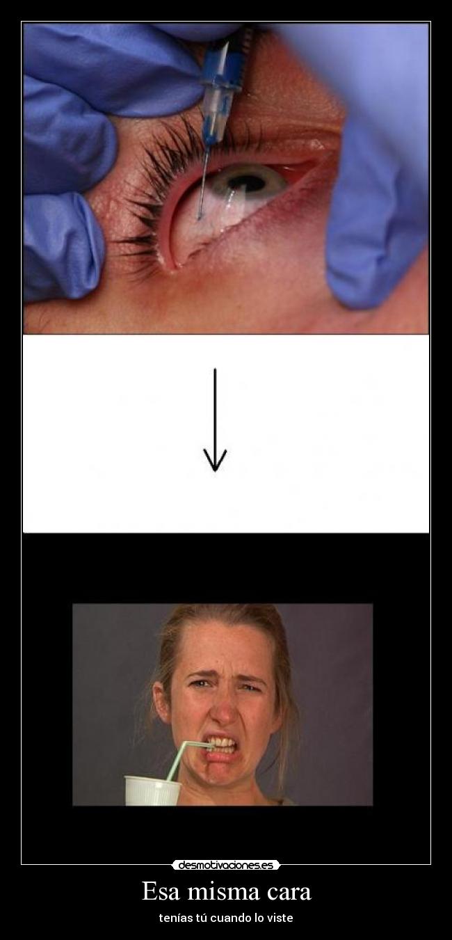 Esa misma cara - tenías tú cuando lo viste