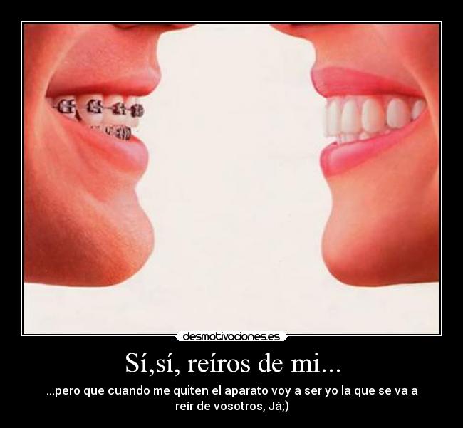 Sí,sí, reíros de mi... - ...pero que cuando me quiten el aparato voy a ser yo la que se va a
reír de vosotros, Já;)