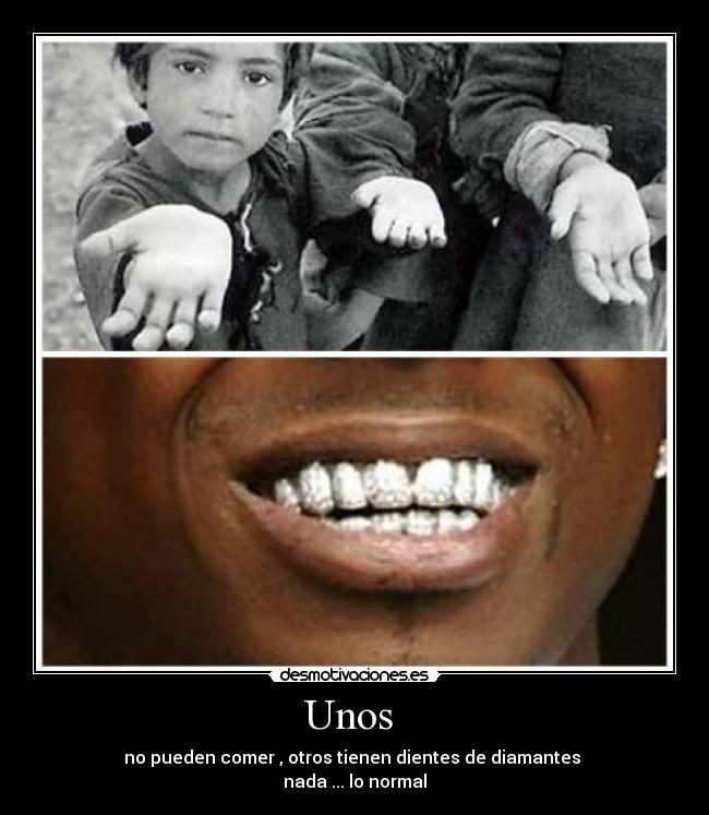 Unos  - no pueden comer , otros tienen dientes de diamantes 
nada ... lo normal
