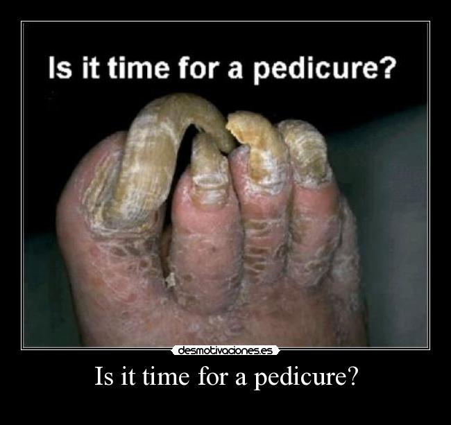 Is it time for a pedicure? -