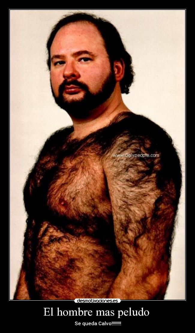 El hombre mas peludo - Se queda Calvo!!!!!!!!