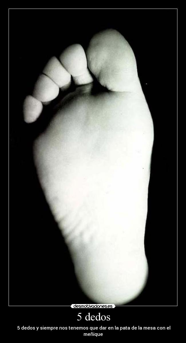 5 dedos -  5 dedos y siempre nos tenemos que dar en la pata de la mesa con el meñique