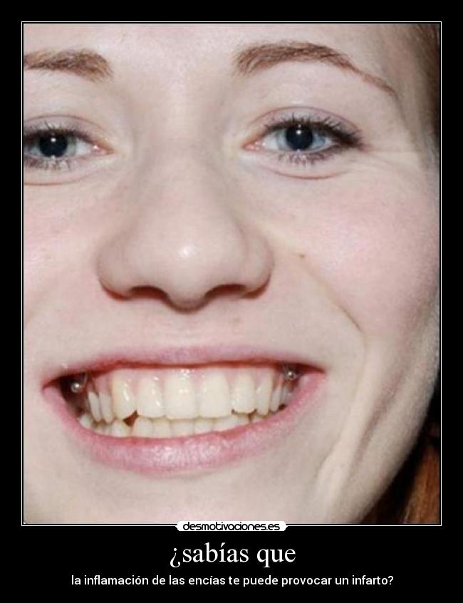 ¿sabías que - la inflamación de las encías te puede provocar un infarto?