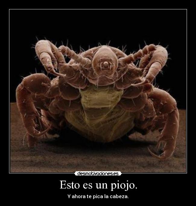 Esto es un piojo. -