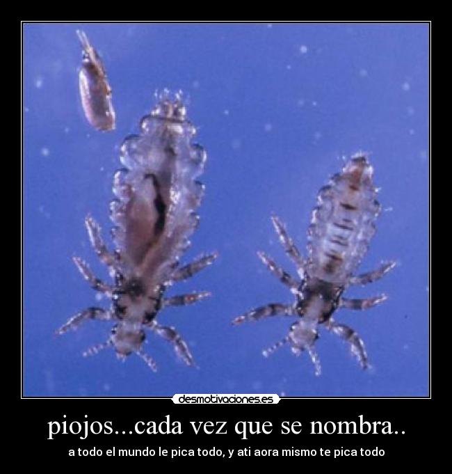 piojos...cada vez que se nombra.. - a todo el mundo le pica todo, y ati aora mismo te pica todo