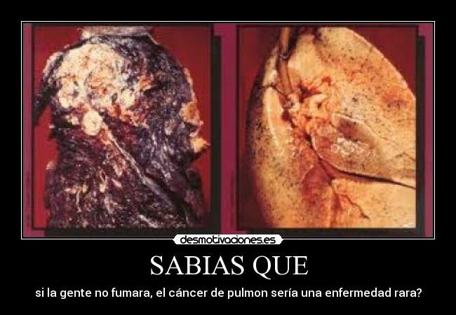 SABIAS QUE - si la gente no fumara, el cáncer de pulmon sería una enfermedad rara?