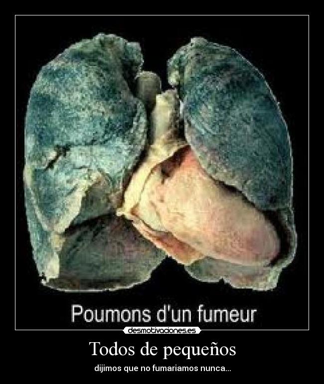 Todos de pequeños -