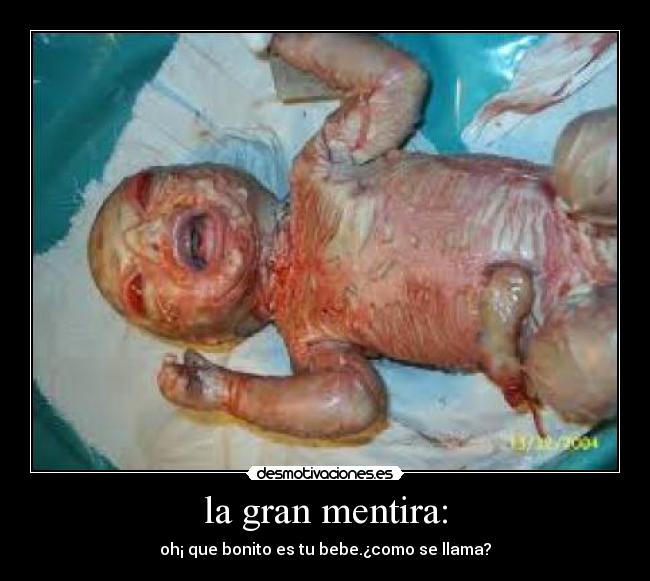 la gran mentira: - oh¡ que bonito es tu bebe.¿como se llama?