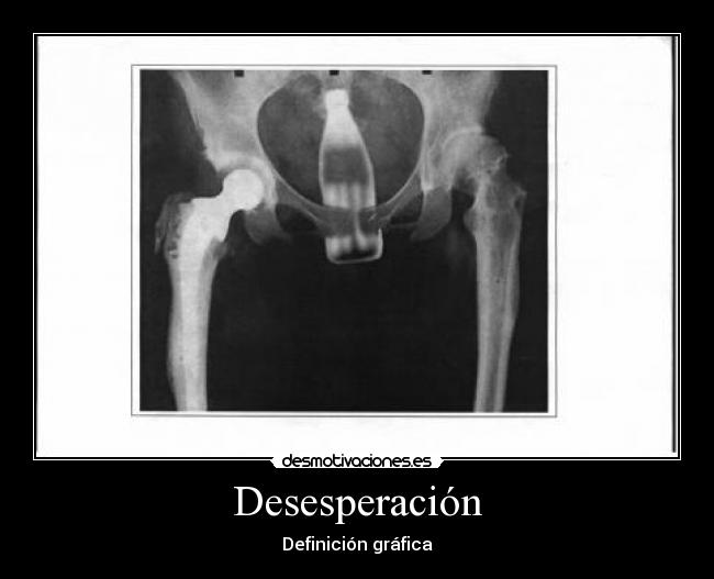 Desesperación -