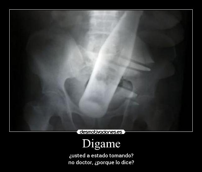 Digame - ¿usted a estado tomando?
no doctor, ¿porque lo dice?