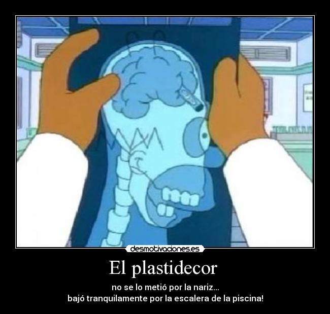 El plastidecor - no se lo metió por la nariz...
bajó tranquilamente por la escalera de la piscina!