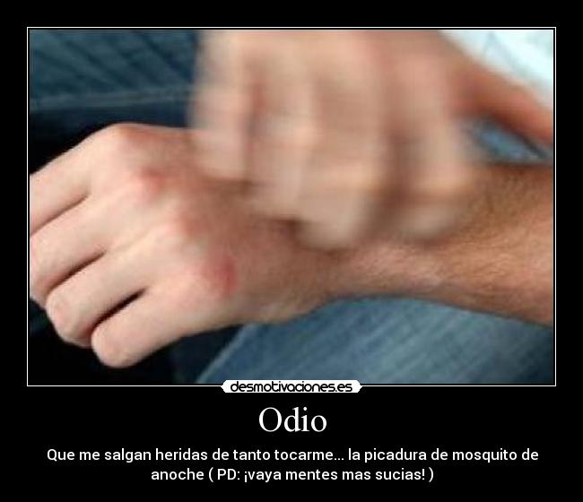 Odio - 