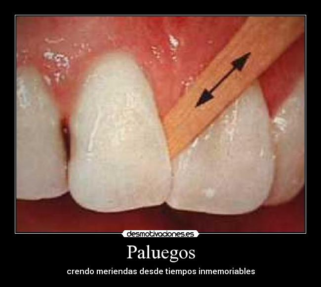 Paluegos - 