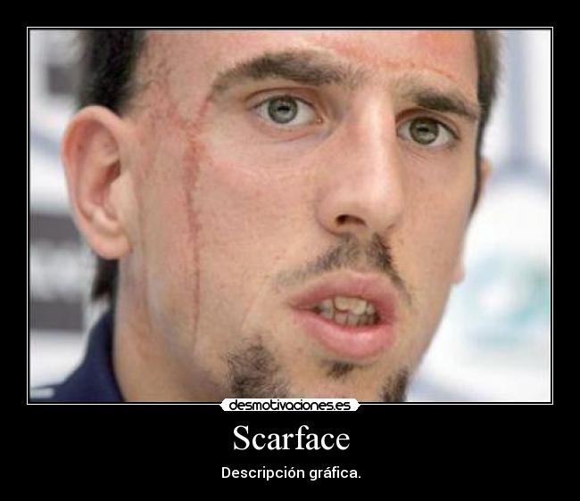 Scarface - Descripción gráfica.