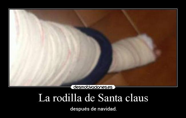 La rodilla de Santa claus - después de navidad.