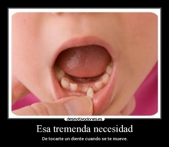 Esa tremenda necesidad - De tocarte un diente cuando se te mueve.