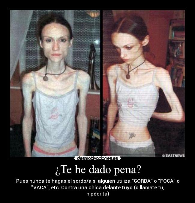 carteles anorexia desmotivaciones